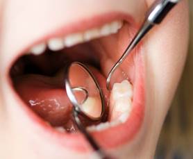 лечение кариеса молочного зуба