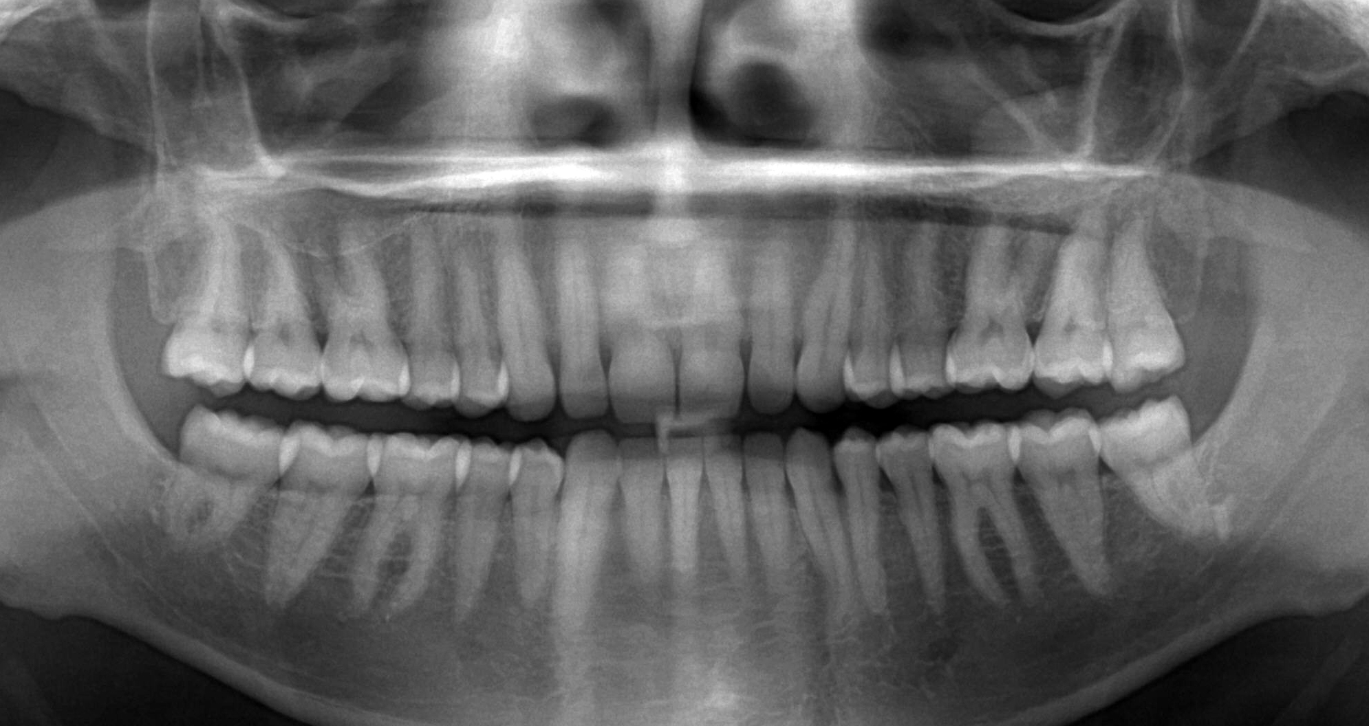 Панорамный снимок зубов в стоматологии Медстар32