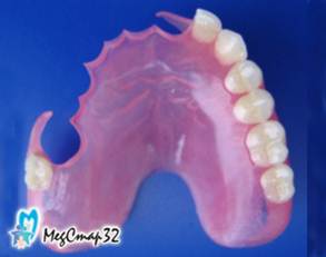 Нейлоновые съёмные зубные протезы